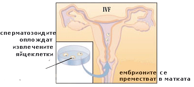 Стерилитетът: Асистираната репродукция